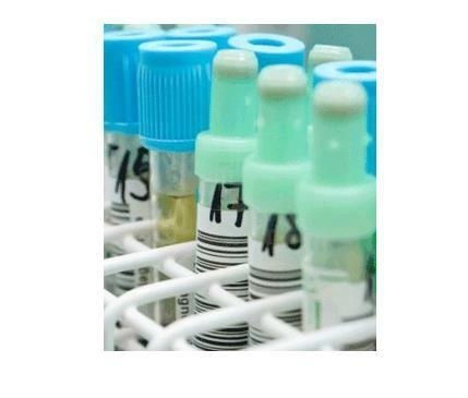 液體藥劑 非即飲型茶的創(chuàng)新應(yīng)用與市場前景